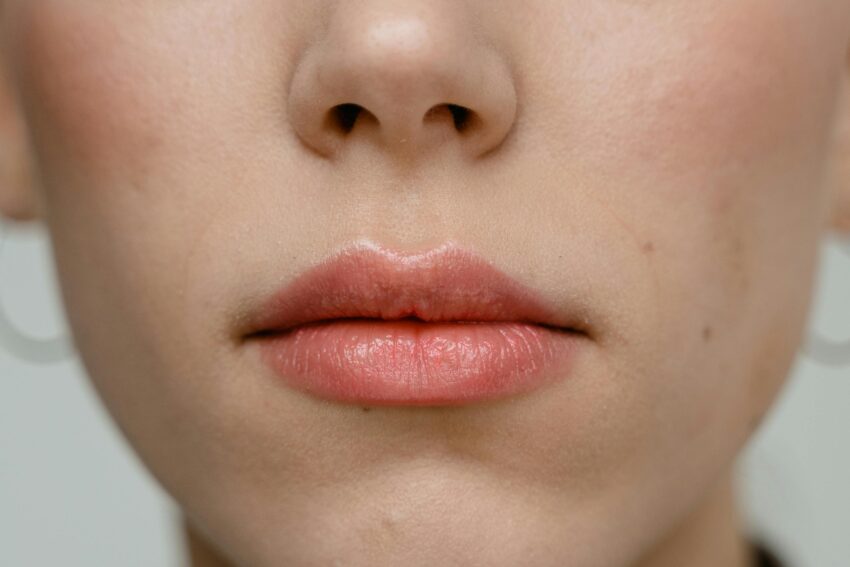 Plump Lips