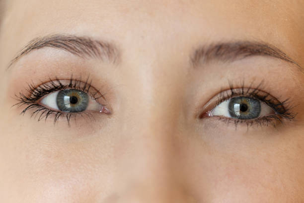 Eyelid Surgery in Riyadh 19