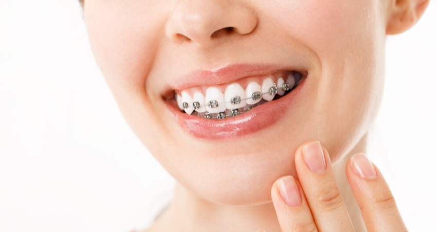 bracestreatment