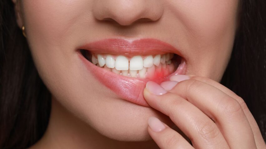 gum treatment