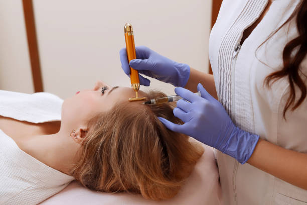 PRP Hair Treatment 20