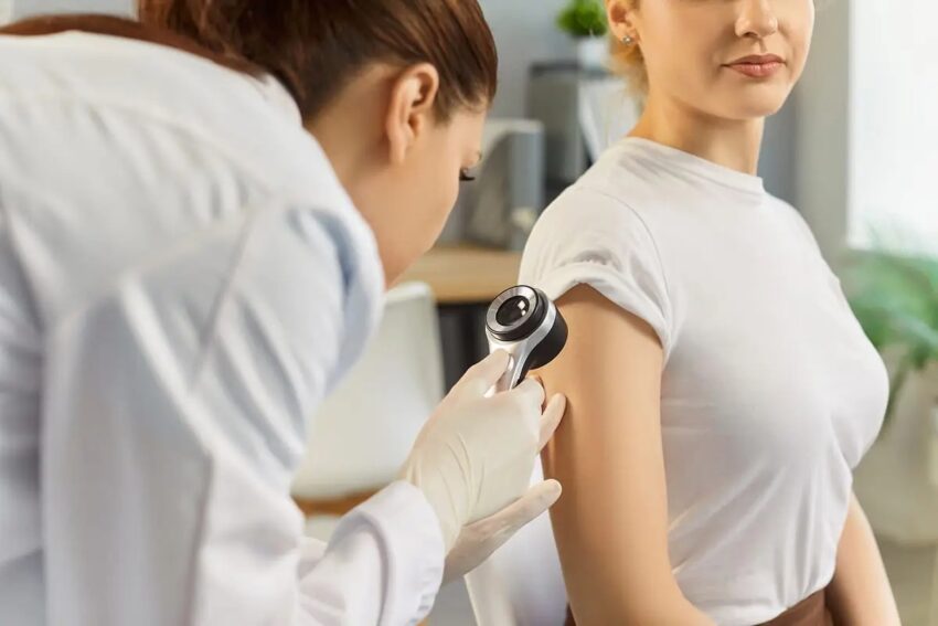 mole check clinic