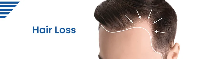 hair loss