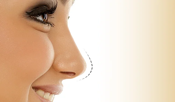 What Age is Best for Rhinoplasty