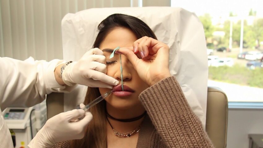 How Do I Know If Lip Fillers Are Right for Me