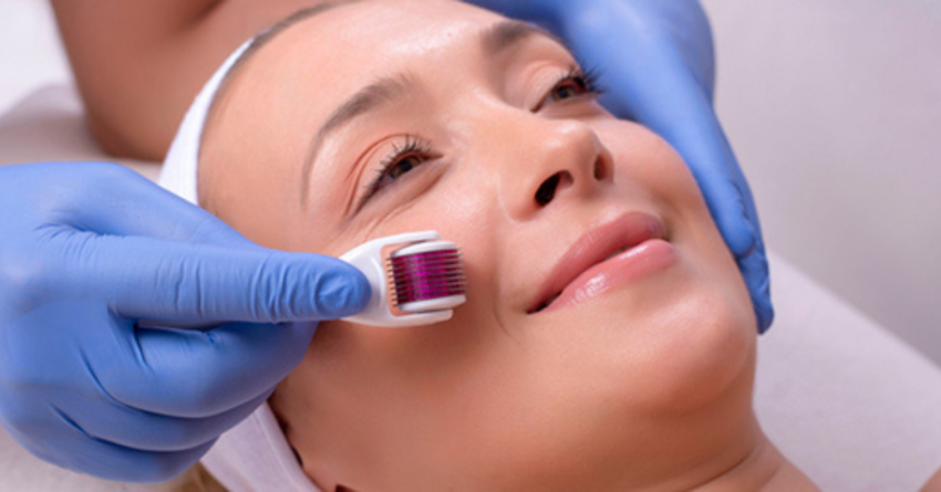 Does Microneedling Treatment Help With Large Pores