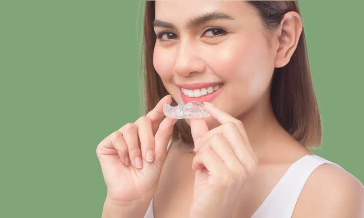 4 Invisalign Treatment