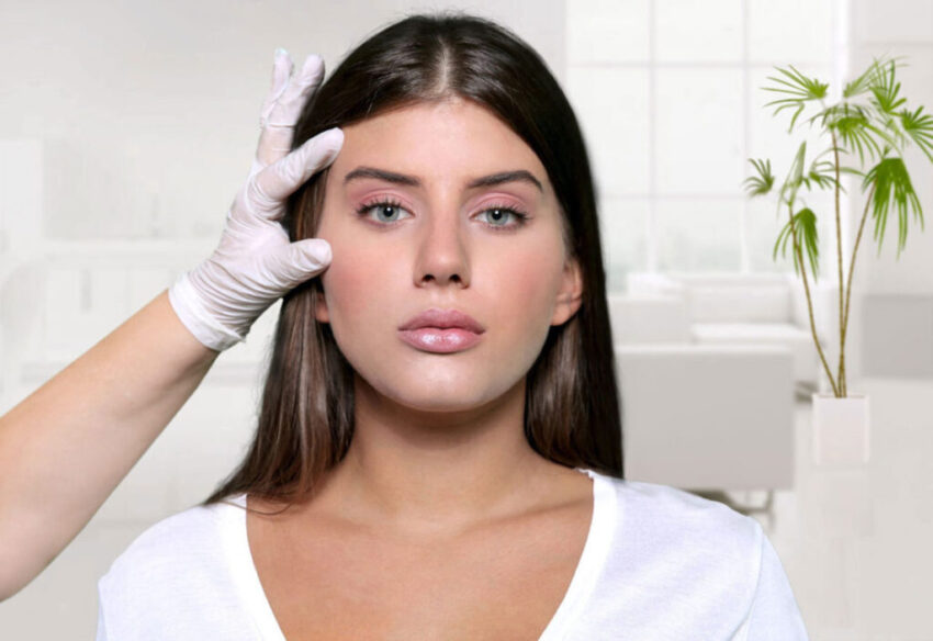 Blepharoplasty 1024