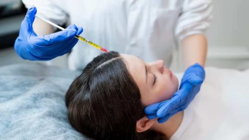 Why is PRP Hair Treatment becoming popular