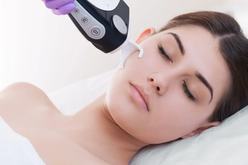 Fractional CO2 laser treatment in Dubai6