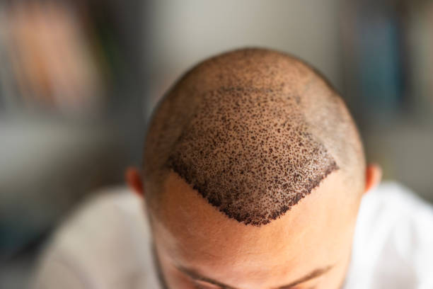 istockphoto 1937985008 612x612 1