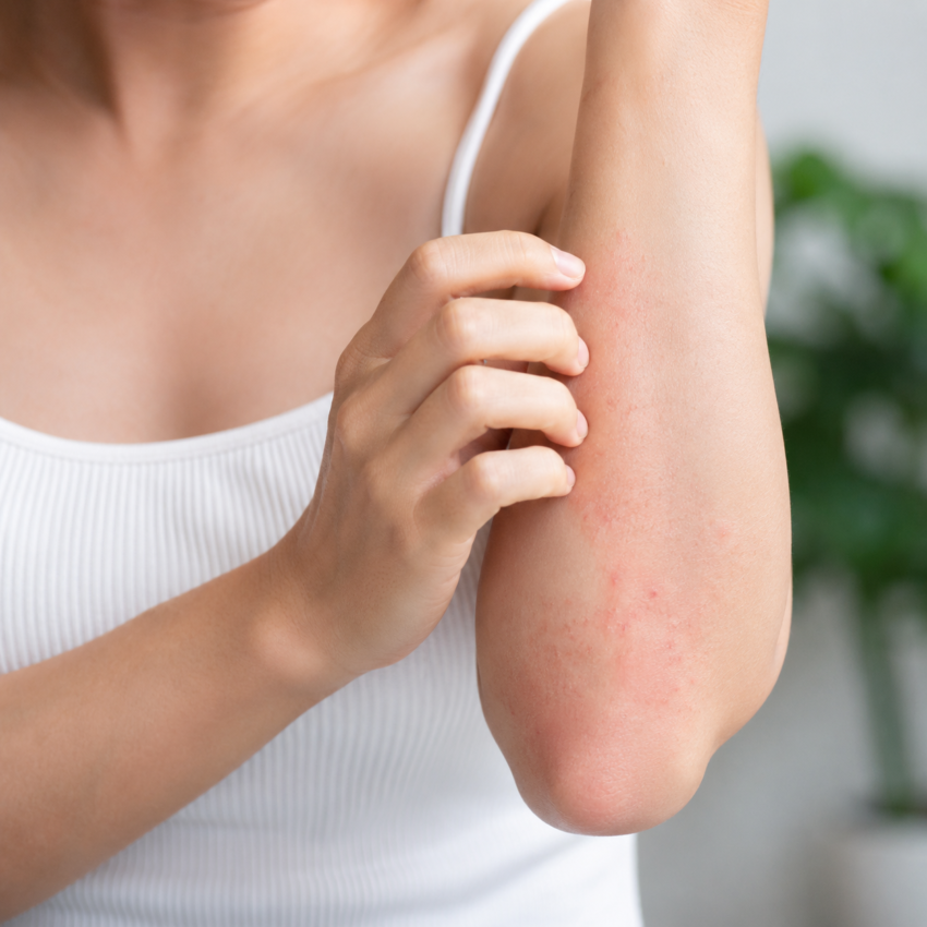 Contact dermatitis treatment near me