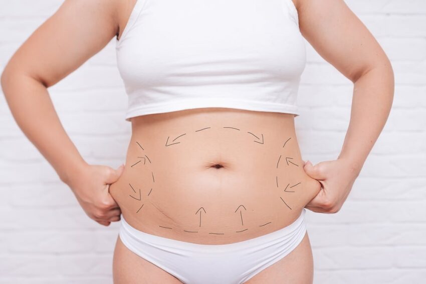 Who is a good candidate for SculpSure Body Contouring