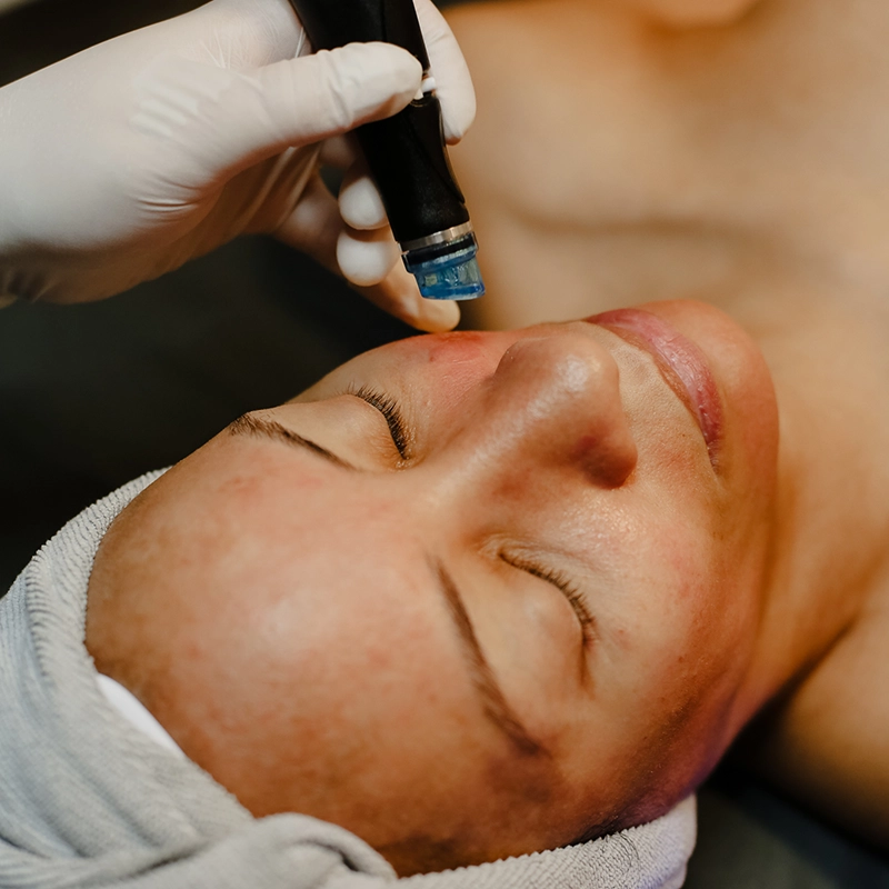 What is the most expensive HydraFacial treatment