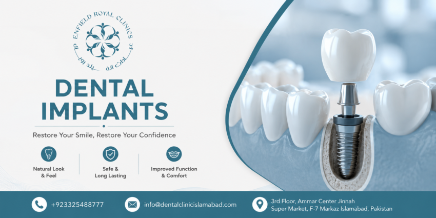 Best Dental Implants in Islamabad