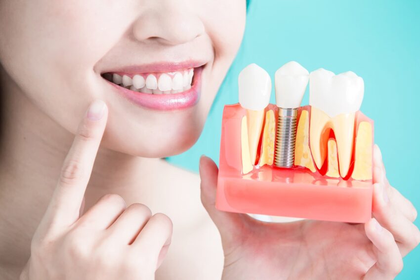 missing teeth dental implant navi mumbai