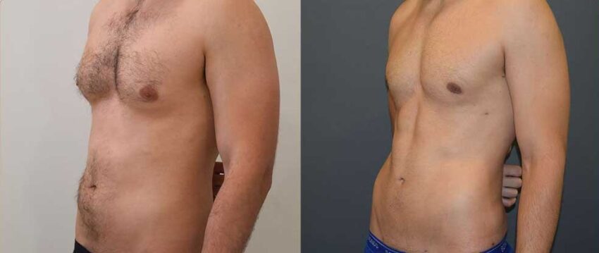 male tummy feature