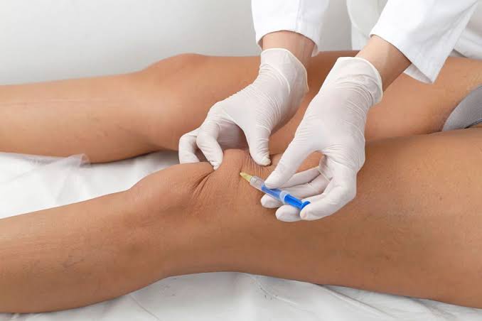 Why More Patients Trust Enfield Royal Clinic for Hyaluronic Acid Injections