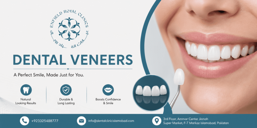 Dental Veneers in Islamabad 1 1
