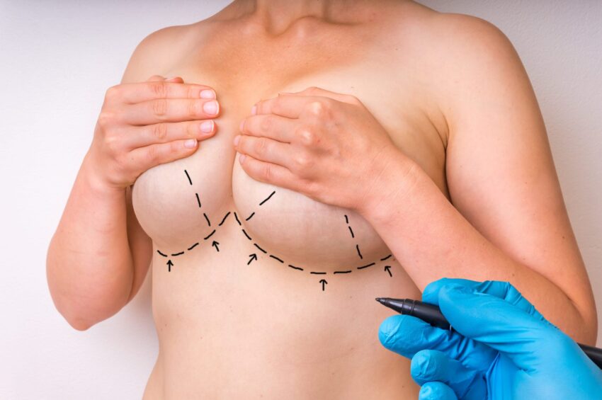 Breast Reduction Surgery chicago female doctor