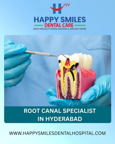 Root Canal Specialist in Hyderabad1 optimized 60