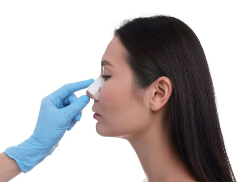 nose surgery