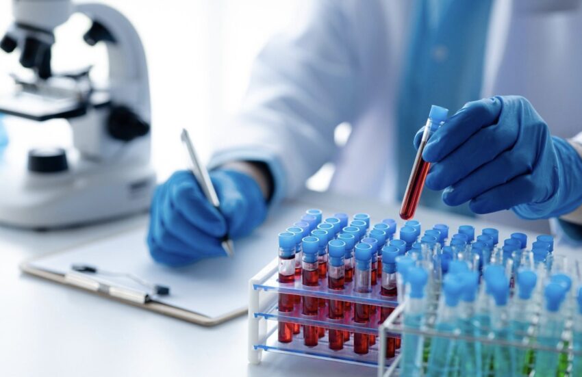 How Lab Testing Helps Detect Health Problems Early