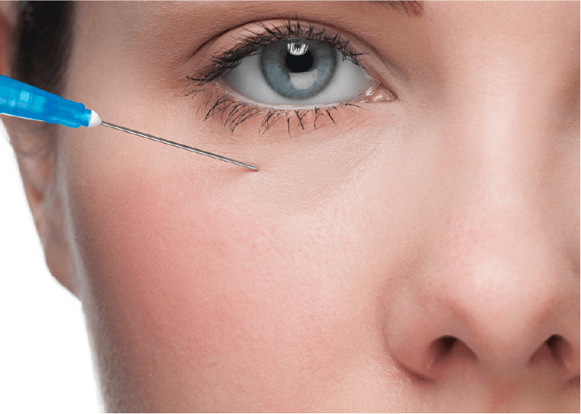 What are the benefits of Under Eye Fillers
