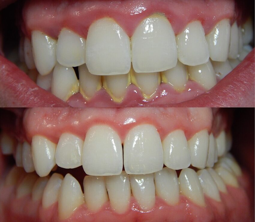 tooth problem