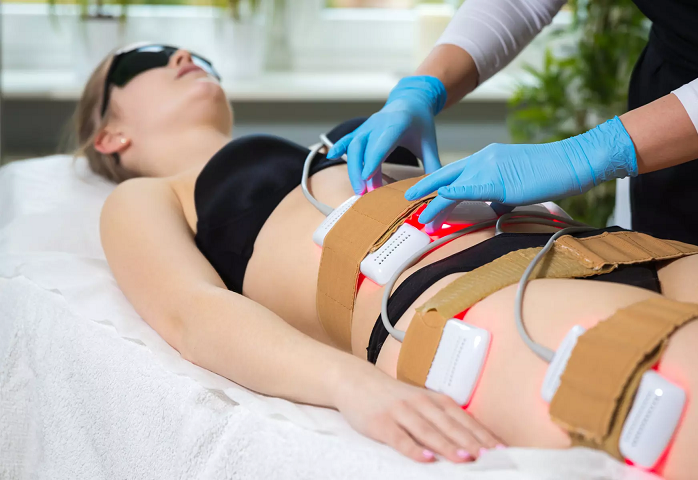 How is Laser Liposuction performed