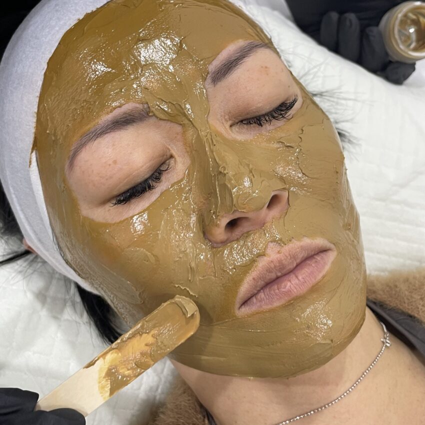 What is Cosmelan Peel