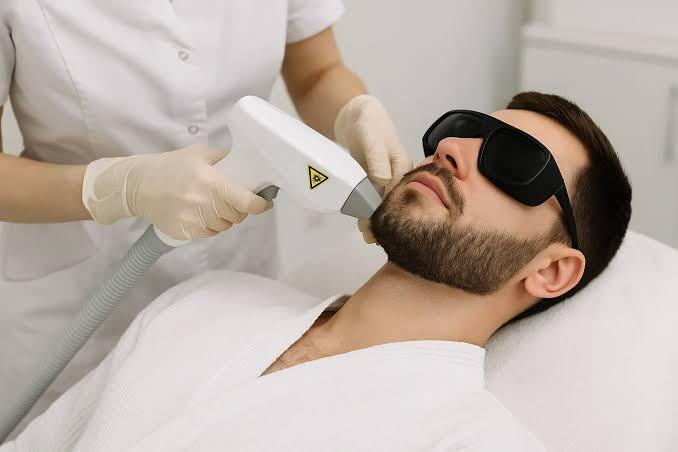 What Makes Beard Laser Hair Removal Popular