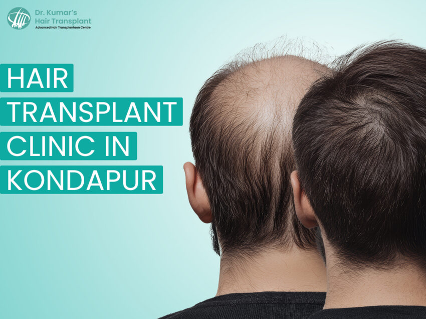 hair clinic dr kumar gmb 1