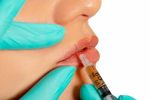 Effortless EleganceWhy More Women Are Choosing Lip Filler Injection