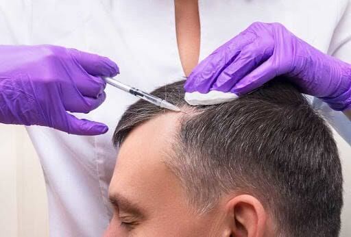 Is Exosomes Therapy Right for Thinning Hair