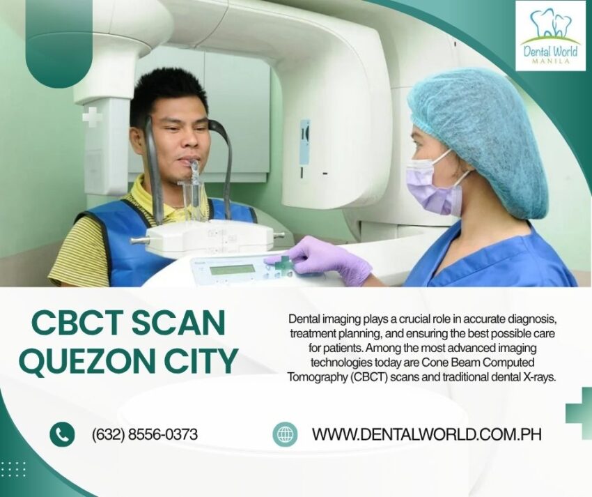 Advanced CBCT Scan Quezon City for Accurate Dental Diagnosis