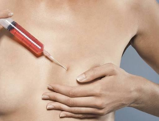 What Results Can Breast Filler Injections Give