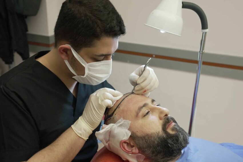 How Can You Find Out if You Qualify for a Hair Transplant