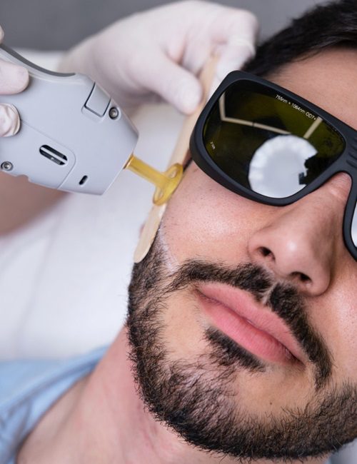 How Safe Is Beard Laser Hair Removal for Men