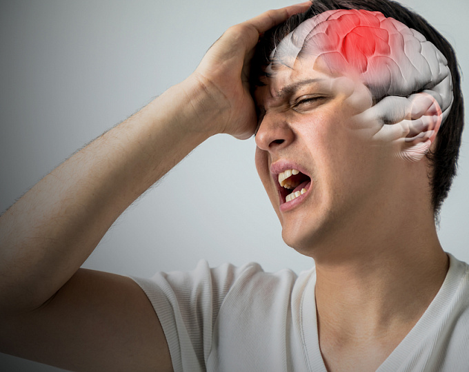 Brain Stroke