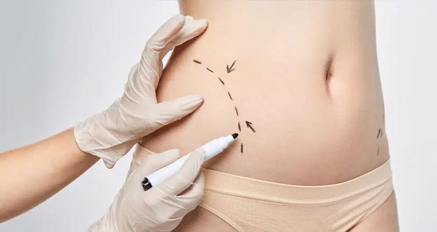 body contouring in Dubai ezgif.com webp to jpg converter