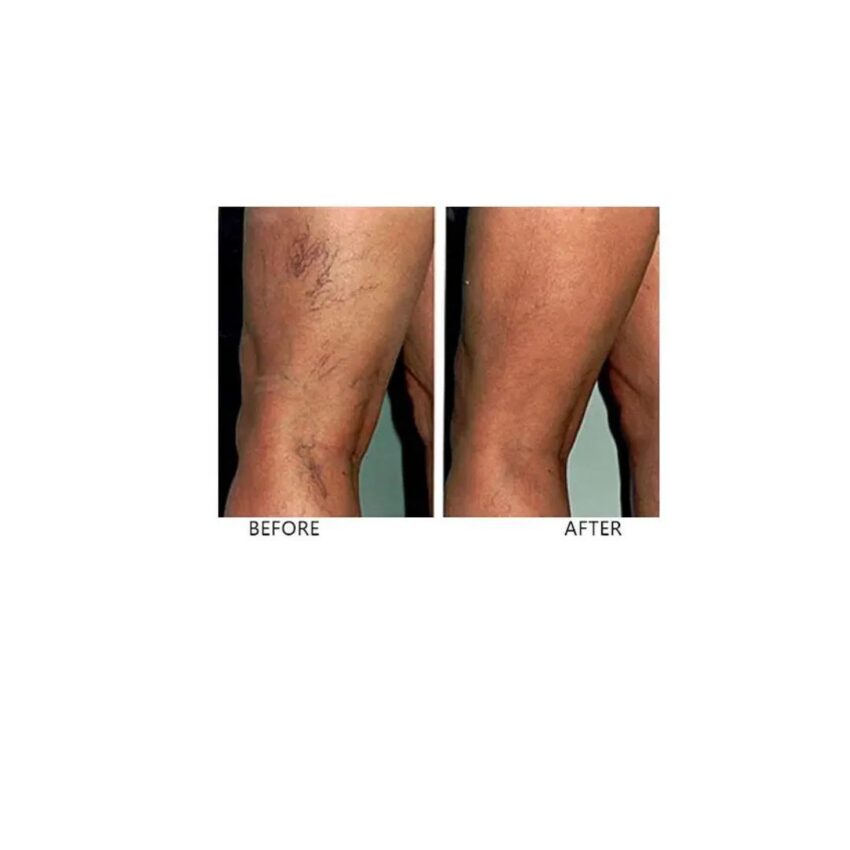 Skincare Laser Centre Guest Blog 1