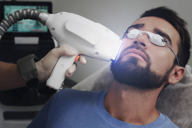 Is Beard Laser Hair Removal Good for Thick Hair