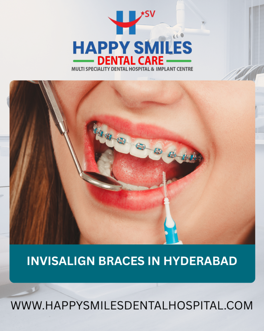 Invisalign braces in Hyderabad