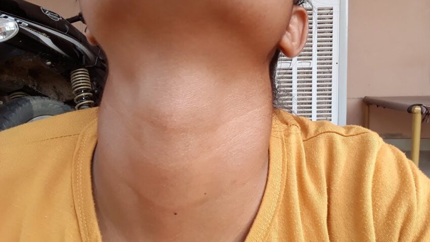 What Is the Dark Neck Treatments Price in Dubai