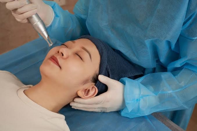 How Can Pico Laser Treatment Improve