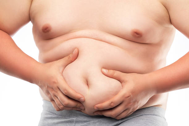 Build Greater Confidence with Gynecomastia Surgery