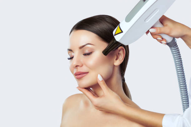 Does Laser Carbon Peel Help Improve Skin Clarity