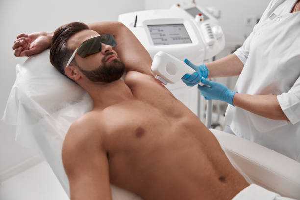 What Should You Know About Beard Laser Hair Removal