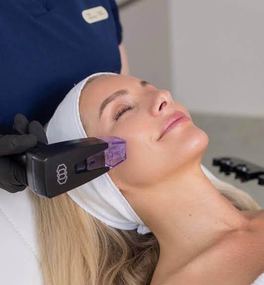 How Does Morpheus8 Treatment Support Firmer Skin